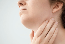 Swollen lymph nodes Allergies