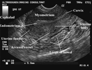 The Importance of Homogeneous Echotexture in Medical Imaging Exams