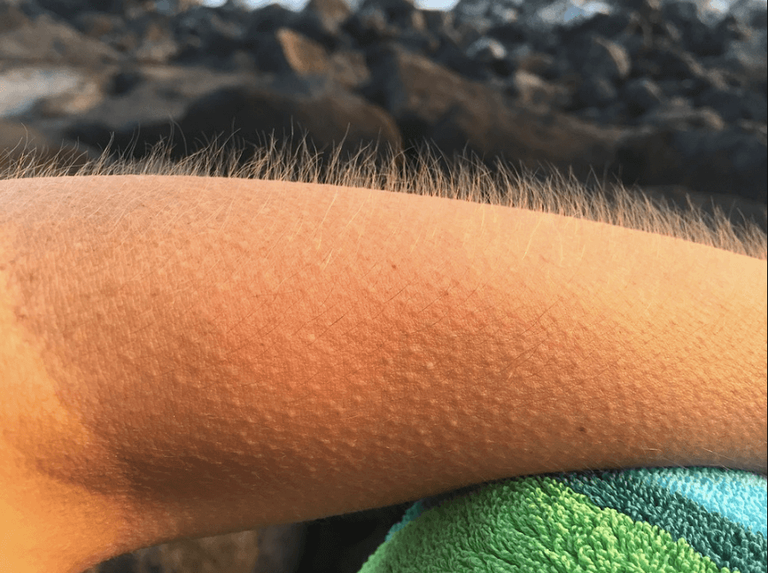 everything-you-need-to-know-about-goosebumps-meaning