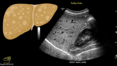 liver parenchyma
