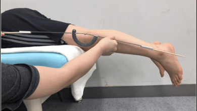 Understanding Genu Recurvatum: Causes, Symptoms, and Treatment Introduction In this article, we will delve into the condition known as "genu recurvatum," which is characterized by hyperextension of the knee joint. This condition. Genu recurvatum, also referred to as "back knee," can affect people of all ages, but it is more prevalent in certain demographics. Understanding the intricacies of this condition is crucial for its proper management and prevention. Let's dive in. What is Genu Recurvatum? Genu recurvatum is a medical term used to describe an abnormal extension of the knee joint, causing the leg to bend backward beyond its normal range of motion.Develop over time due to various factors. Causes of Genu Recurvatum Muscle Imbalance: One of the primary causes of genu recurvatum is an imbalance in the muscles surrounding the knee joint. Weak quadriceps and overactive hamstrings can lead to excessive knee extension. Joint laxity: Individuals with hypermobile or loose ligaments around the knee may be more susceptible to genu recurvatum. Previous Injuries: Trauma or injuries to the knee joint can cause structural changes, leading to abnormal knee extension. Neuromuscular Conditions: Certain neuromuscular disorders, such as cerebral palsy, can result in the development of genu recurvatum. Genetics: There may be a genetic predisposition to developing this condition, although further research is needed to fully understand the genetic links. Identifying the Symptoms The symptoms of genu recurvatum can vary depending on the severity of the condition: H2: Mild Genu Recurvatum Hyperextension: The knee may extend slightly beyond the normal range of motion. H2: Moderate Genu Recurvatum Visible Deformity: The abnormal knee extension becomes more evident. Knee Pain: Discomfort and pain may be experienced, especially after physical activity. H2: Severe Genu Recurvatum Difficulty Walking: Severe cases can lead to difficulties in walking and performing daily activities. Instability: The knee joint may feel unstable, increasing the risk of falls. Diagnosis If someone experiences symptoms suggestive of genu recurvatum, a comprehensive evaluation is necessary. A medical professional will: Perform Physical Examination: Assess the range of motion in the knee joint and look for signs of instability. Review Medical History: Understand any past injuries or medical conditions that might contribute to the development of genu recurvatum. Imaging Tests: X-rays, MRIs, or CT scans may be ordered to visualize the knee joint's alignment and detect any structural abnormalities. Treatment Options The treatment for genu recurvatum aims to alleviate symptoms and improve the stability of the knee joint. The approach may include: H2: Physical Therapy Strengthening Exercises: Targeting the quadriceps and hamstrings can help restore balance to the muscles surrounding the knee. Flexibility Exercises: Stretching tight muscles can improve the knee's range of motion. H2: Orthotic Devices Braces or Splints: These can provide support to the knee and limit excessive extension. H2: Assistive Devices Canes or Walkers: In severe cases, these devices can assist with walking and reduce the risk of falls. H2: Surgery Tendon Lengthening: Surgical procedures may be considered in extreme cases to address severe muscle imbalances. Preventing Genu Recurvatum While some causes of genu recurvatum are beyond our control, certain preventive measures can be taken: Proper Warm-up: Engage in stretching and warm-up exercises injury. Strength Training: Regularly strengthen the muscles surrounding the knee joint to enhance stability. Conclusion Genu recurvatum is a condition that requires careful evaluation and management. Individuals affected by this condition can seek appropriate care and support. If you or someone you know experiences symptoms of genu recurvatum, consult a healthcare professional for a thorough assessment. FAQs H3: Is genu recurvatum preventable? While not all cases are preventable, maintaining strong muscles around the knee joint and practicing proper warm-up techniques can reduce the risk. H3: Can genu recurvatum occur in both knees? Yes, it is possible for both knees to be affected, though it may vary in severity. H3: What age group is more susceptible to genu recurvatum? Genu recurvatum can affect individuals of all ages, but it is more commonly seen in older adults and athletes involved in high-impact sports. H3: Can physical therapy alone correct genu recurvatum? In mild cases, physical therapy may be sufficient to improve symptoms. However, more severe cases might require additional interventions. H3: How long does the recovery process take after surgery? The recovery time surgery.