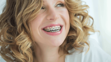 delta dental orthodontic coverage