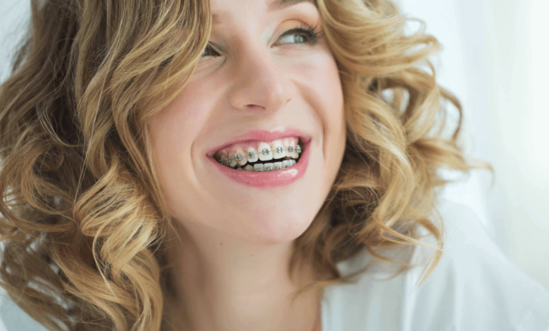 delta dental orthodontic coverage