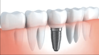will medicare pay for dental implants