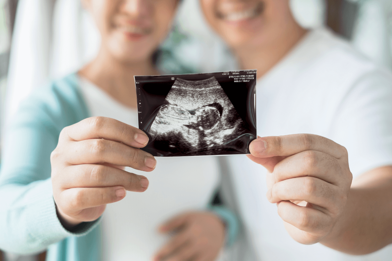 Understanding the Miracle: 14 Weeks Pregnant Ultrasound