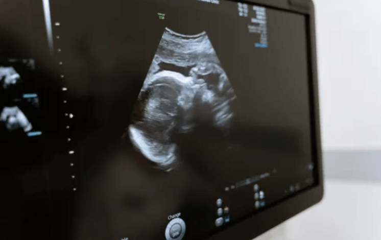 5 months pregnant ultrasound