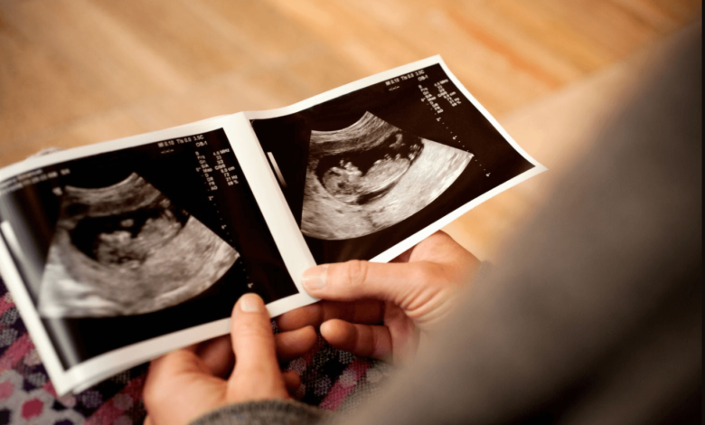 boy or girl ultrasound
