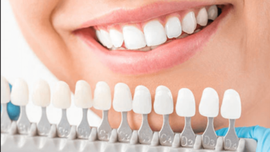 how much do dental veneers cost