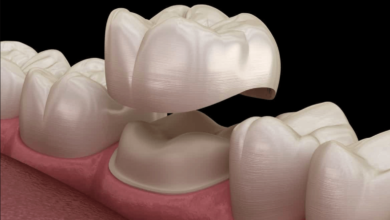 how much does a dental crown cost