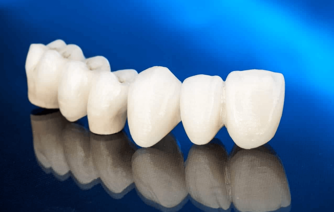 Section Bridge Dental Code A Comprehensive Guide   Section Bridge Dental Code 1 