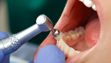dental cleaning without insurance
