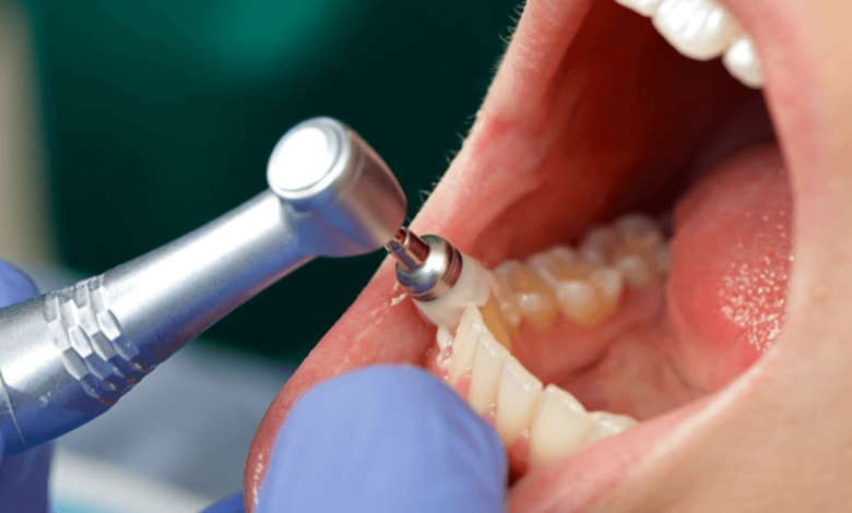 dental cleaning without insurance