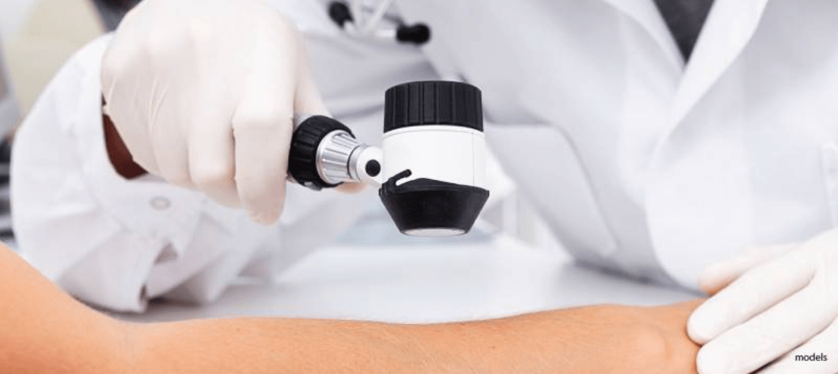 Dermatologist Cyst Removal Cost Unveiling the Financial Aspect of Skin