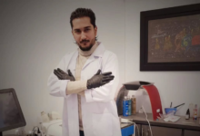 Shah Hassan Ch’s Revolutionary Acne Pitted Scars Treatment