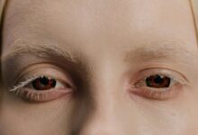 bold change initiative launch