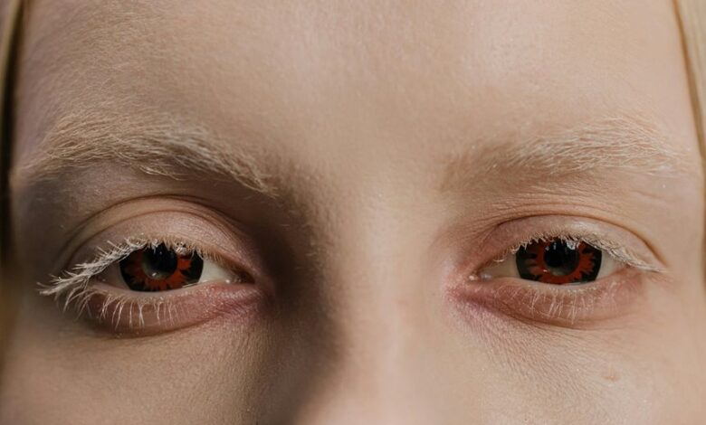 bold change initiative launch