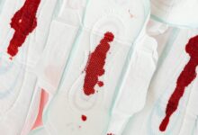 prolonged light flow menstruation symptoms