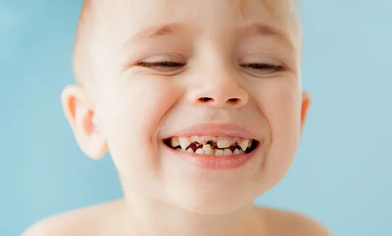 Small Cavities, Bigger Consequences: The Connection Between Dental Fillings and Preventive Oral Care